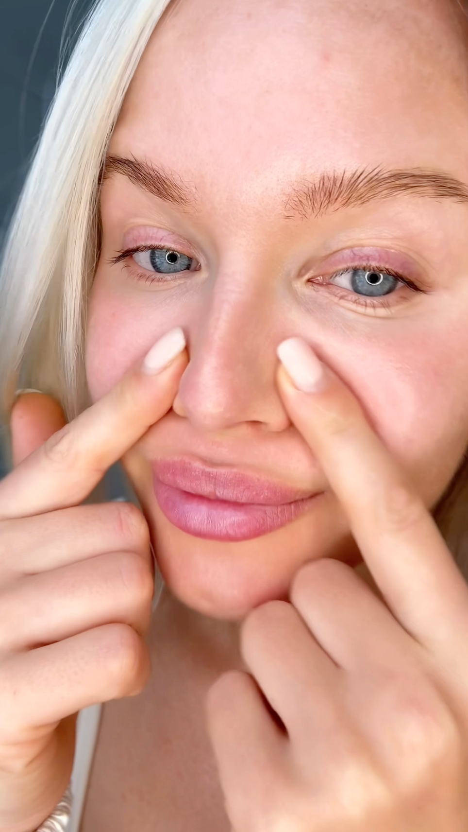 Smooth skin after a nose patch
