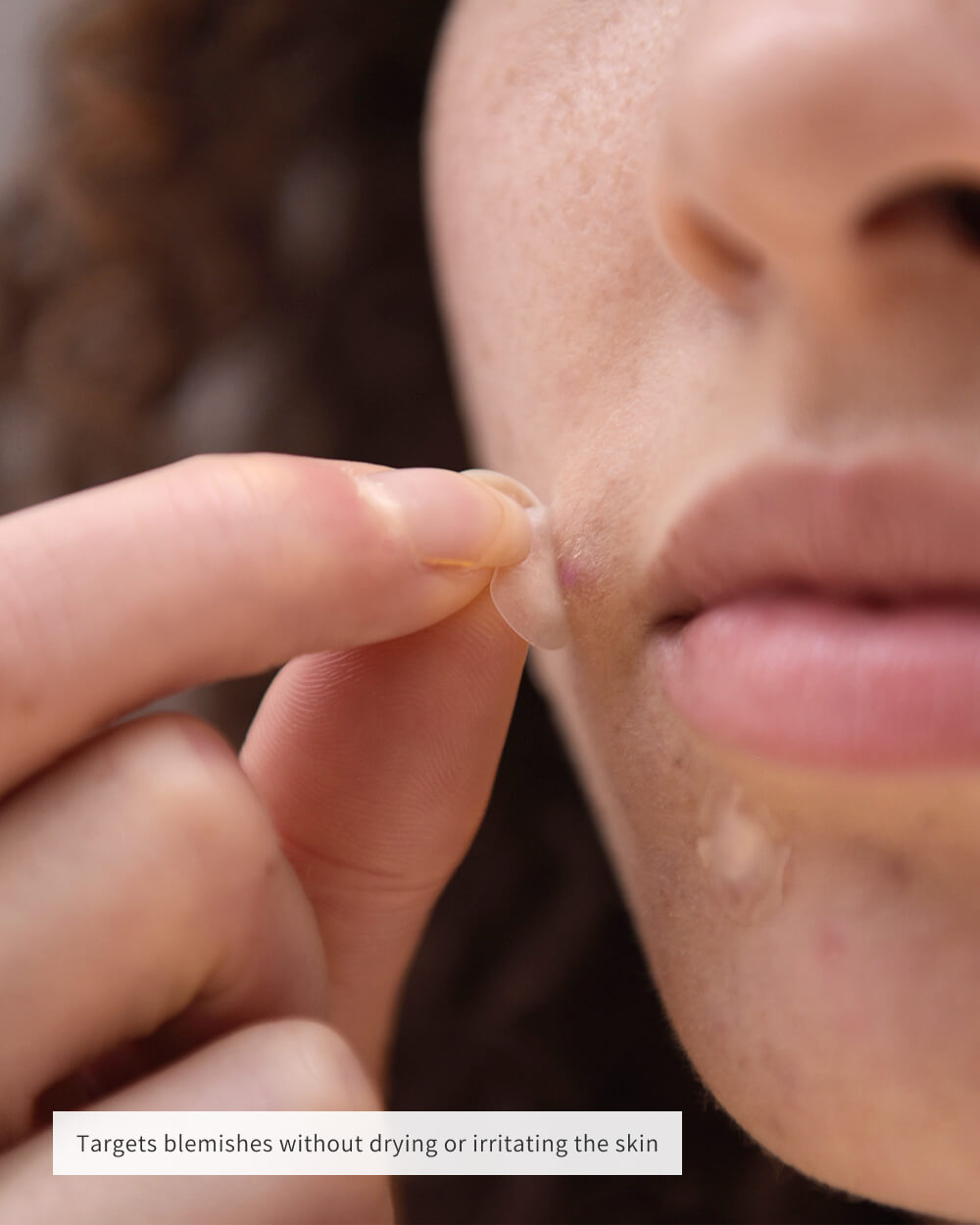 CLEARING SPOT PATCHES